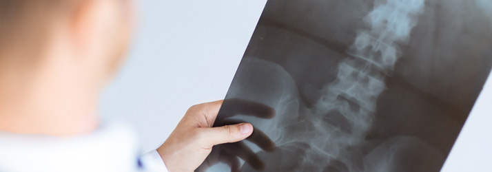 Scoliosis Solutions Victoria BC Services and Techniques Scoliosis Solutions Victoria BC Services and Techniques